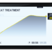 HORNO CARGA SUPERIOR TOP 100 - Segmentdarstellung.png